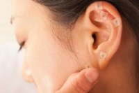 Curso de Auriculoterapia